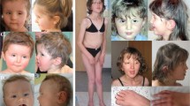 new research on down syndrome