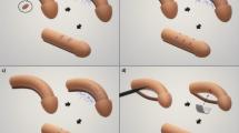 Congenital Penile Curvature: Update and Management | Current Urology Reports