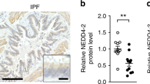 conditional gene expression in the respiratory epithelium of the mouse conditional gene expression in the respiratory epithelium of the mouse