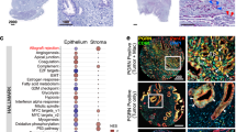 PGRN inhibits CD8+T cell recruitment and promotes breast cancer ...