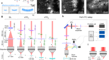 Diesel2p mesoscope with dual independent scan engines for flexible capture  of dynamics in distributed neural circuitry
