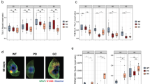 A reversible state of hypometabolism in a human cellular model of ...
