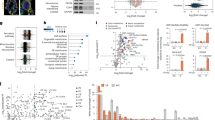 Timing of developmental reduction in epithelial glutathione redox potential  is associated with increased epithelial proliferation in the immature  murine intestine | Pediatric Research