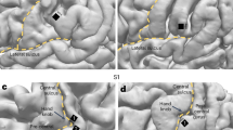 research on photographic memory