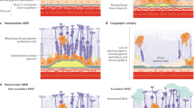 new research on vitreous floaters