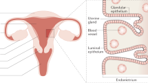 research paper on ovarian cancer