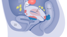 research on endometriosis