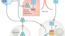 case study of hypothyroidism