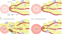 new research crohn's disease