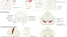 cholinergic hypothesis alzheimer's wikipedia