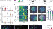 new research dementia alzheimer's