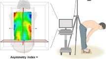 Moiré topography—A method for school screening of scoliosis | Archives of Orthopaedic and Trauma Surgery