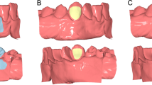 lateral excursion of tooth