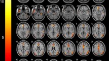 frontal lobe stroke case study
