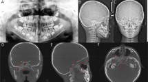 thesis on cephalometric analysis