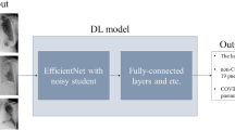 essay about covid 19 using modals