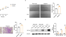 The regulation of hypoxia-related lncRNAs in hepatocellular carcinoma ...