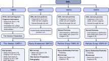 thesis on kidney stones