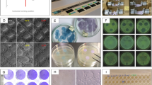 Highly efficient and durable antimicrobial nanocomposite textiles