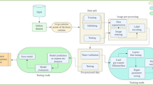 brain tumor segmentation research paper