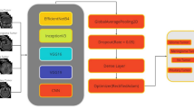 Employing deep learning and transfer learning for accurate brain tumor ...