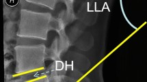 spondylolisthesis symptoms lumbar