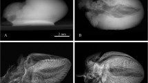 A method to use X-ray computed tomography for measuring perfusable ...
