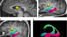 glutathione psychosis A summary of potential targets for the treatment of psychosis