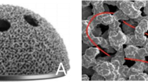 A new 3D printing porous trabecular titanium metal acetabular cup for ...