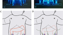 Comparing robot-assisted versus laparoscopic Ladd's procedure in ...