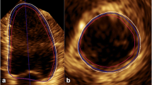 Optimal left ventricular diameter measurement in subjects with sigmoid ...