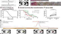 Non small cell lung cancer with SMARCA4 deficiency harboring rare EGFR ...