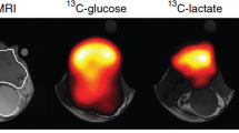 Computational Molecular Magnetic Resonance Imaging for Neuro 