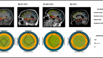 Brain age as an accurate biomarker of preclinical cognitive decline ...