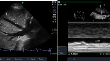 A comprehensive review of venous excess ultrasound (VExUS) score ...