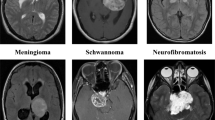 Enhancing Brain Tumor Detection in MR Images Using Modified Few-Shot ...