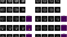Visual Image Algorithm Mri Pre-to-Post Operative MRI Generation with Retrieval-Based Visual In ...