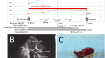 Analysis of risk factors for left atrial appendage thrombus formation ...