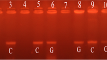 Interferon lambda polymorphisms associate with body iron indices ...