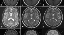 Deep learning for accelerated and robust MRI reconstruction | Magnetic ...