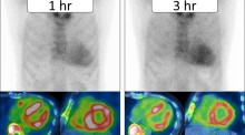 Volume 39, Issue 10 | Annals of Nuclear Medicine | Springer Nature Link