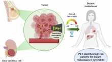 Volume 17, Issue 9 | EMBO Molecular Medicine | Springer Nature Link