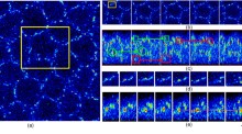 Computational methods in microscopy image analysis | Springer Nature Link