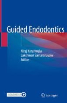 Dynamic Navigation in Endodontics | SpringerLink
