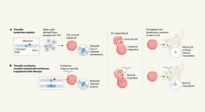 latest research on what causes autism