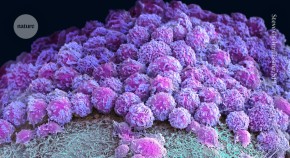 cancer research latest findings