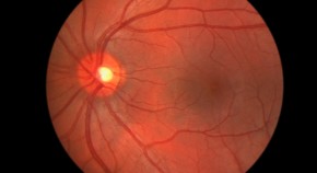 research topics in ophthalmology