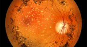 Springer Real Analysis Clinical trials - Latest research and news | Nature
