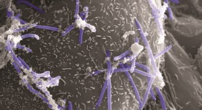 SEM image bacteria on cell
