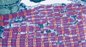 Striated skeletal muscle